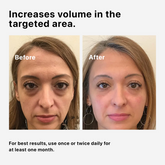 Volufiline 100%