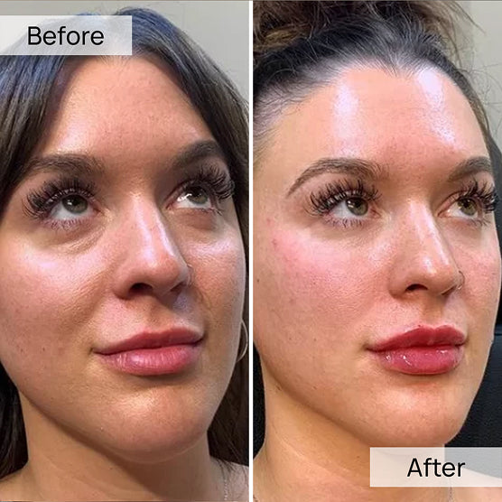 100% Volufiline 30ml
